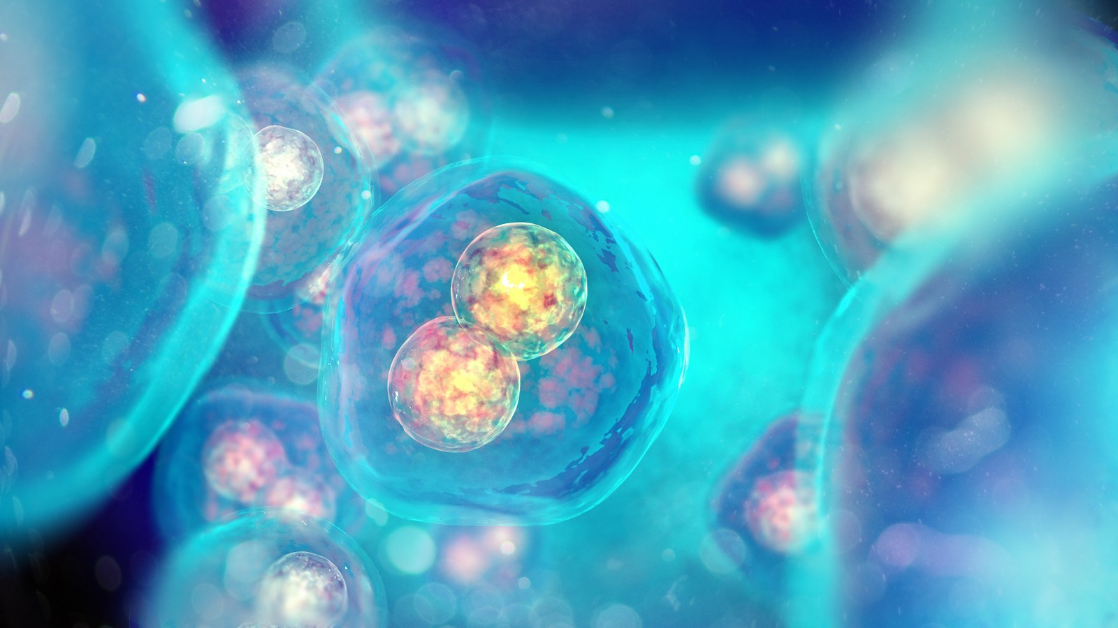 The Role of Inflammation in Parkinson's Disease